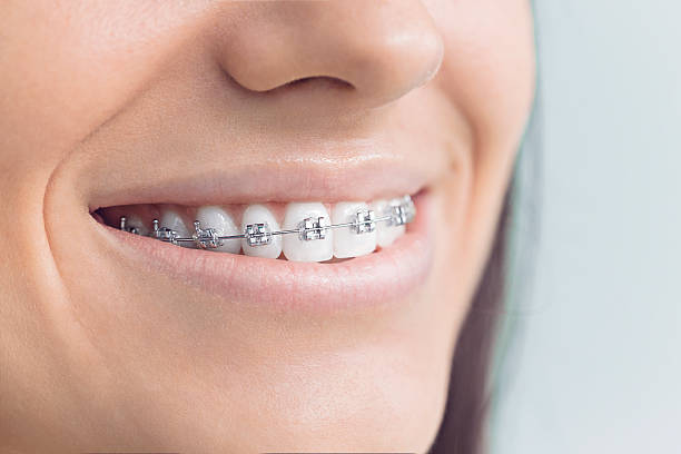 Full Mouth Reconstruction in Schererville, IN